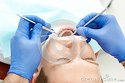 Dental checkup of the pacient Stock Photo