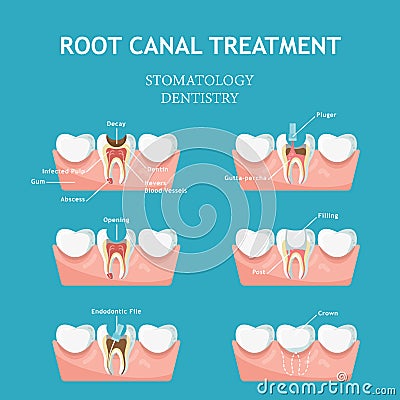 Dental concept. Dentistry and stomatology poster. Cavities and chipped Vector Illustration