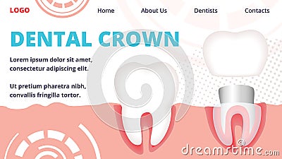 Dental Crown Horizontal Banner. Tooth Restoration Vector Illustration