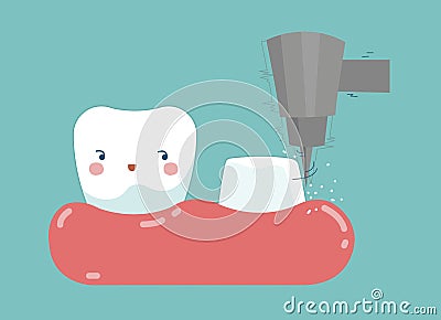 Dental crown installation process , tooth and teeth of dental concept Vector Illustration