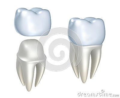 Dental crowns and tooth Stock Photo