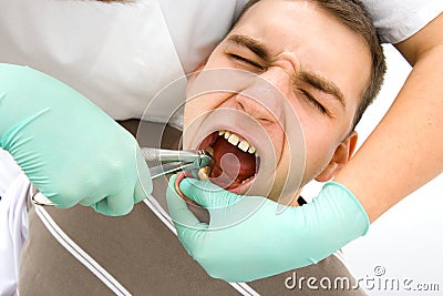 Dental extraction Stock Photo