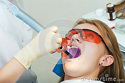 Dental filing of child tooth by ultraviolet light Stock Photo