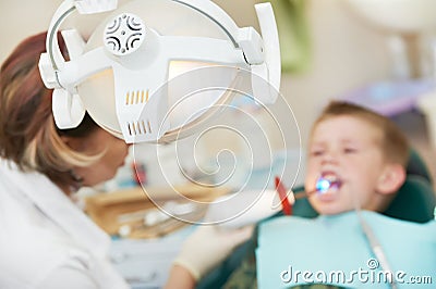 Dental filing of child tooth by ultraviolet light Stock Photo