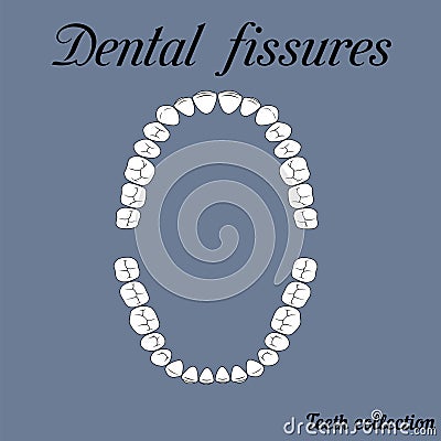 Dental fissures Vector Illustration