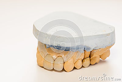Dental gypsum model in dentist laboratory office - close-up. Gypsum Dentures with porcelain teeth isolated on white background Stock Photo