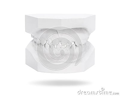 Dental gypsum model of teeth isolated on white background. Template of teeth made from plaster. Clipping paths object Stock Photo