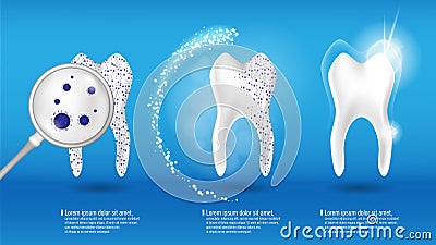 Dental health Concept Vector set. 3d realistic shiny clean and dirty tooth on blue background, clearing and Whitening Vector Illustration