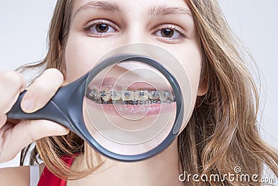 Dental Health and Hygiene Concepts. Caucasian Female Demonstrating Her Teeth Stock Photo