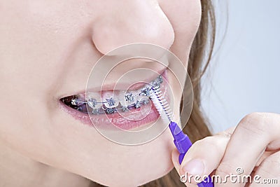 Dental Hygiene Concepts. Closeup Shot of Caucasian Teenage Girl Stock Photo