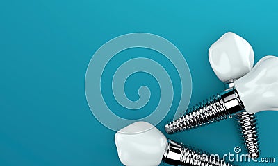 Dental implants on blue background Stock Photo