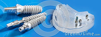 Dental implants Stock Photo