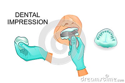 Dental impression, dentistry Vector Illustration