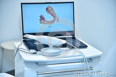 Dental intraoral 3d scanner and laptop on table Stock Photo