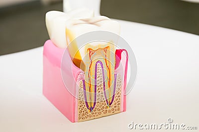 Dental model anatomy of the tooth cross-section dentist concept for education Stock Photo