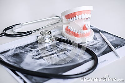 Dental model and equipment on tooth x-ray film and stethoscope used in the treatment of dental and dentistry by dentist Stock Photo