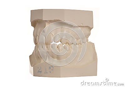 Dental model of human teeth on white Stock Photo