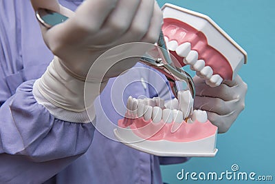 The dental model is used to Demonstration of tooth extraction by doctors. Stock Photo