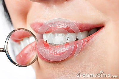 Dental mouth mirror near healthy white woman teeth Stock Photo