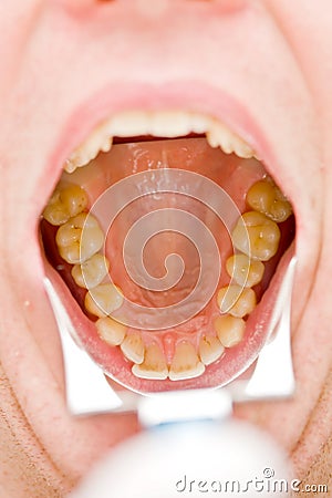 Dental photography Stock Photo