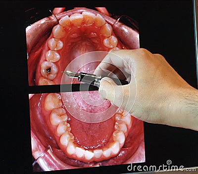 Dental photography study Stock Photo