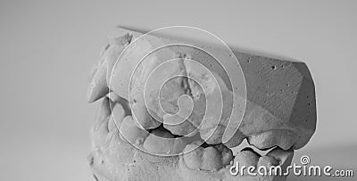 Dental plaster cast of teeth for the manufacture of orthodontic apparatus. Children's orthodontics Stock Photo