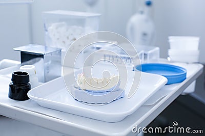 Dental plaster mold Stock Photo