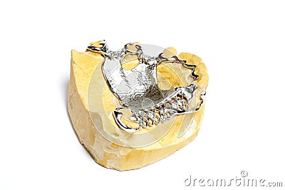Dental plaster moulds, Dentures Stock Photo