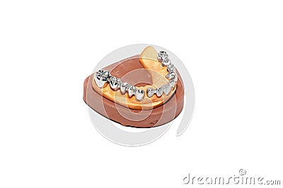 Dental plaster moulds, Dentures Stock Photo