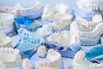 Dental plaster moulds and imprints Stock Photo