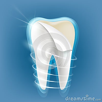 Dental porcelain veneers Vector Illustration