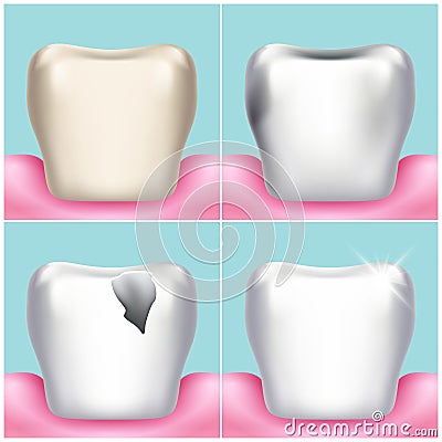 Dental problems, caries, plaque and gum disease, healthy tooth vector illustration Vector Illustration