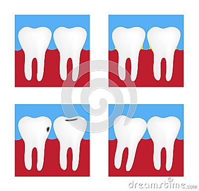 Dental Problems , Health Care of Tooth Set Vector Illustration