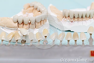 Dental prostheses close up Stock Photo