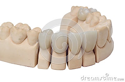 Dental prosthesis Stock Photo