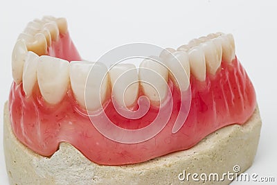 Dental prosthesis Stock Photo