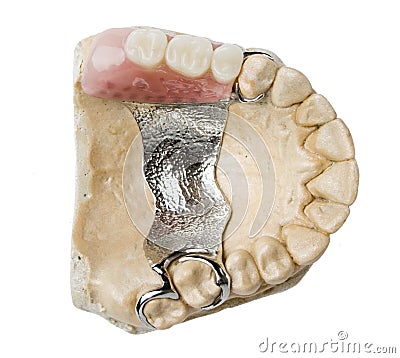 Dental prosthesis Stock Photo