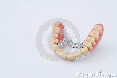 Dental prosthesis Stock Photo