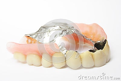 Dental prosthesis, dentures porcelain Stock Photo