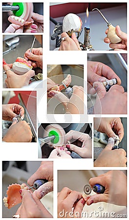 Dental prosthesis preparation process Stock Photo