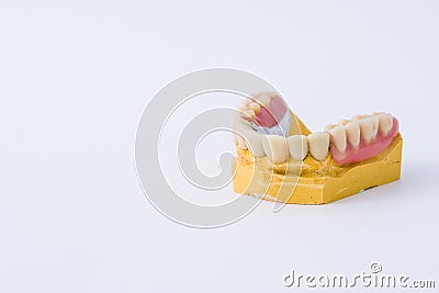 Dental prosthesis over a mold Stock Photo