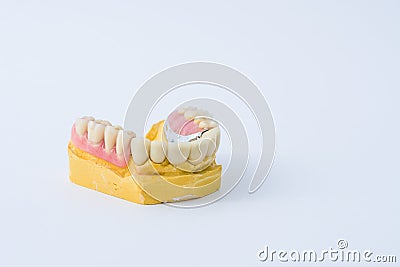 Dental prosthesis over a mold Stock Photo