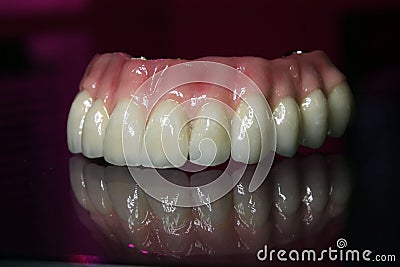 Dental prosthesis on the maxilla zirconia on implants Stock Photo