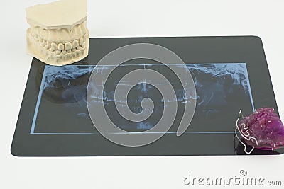 Dental radiology, jaw cavity and monobloc prosthesis Stock Photo