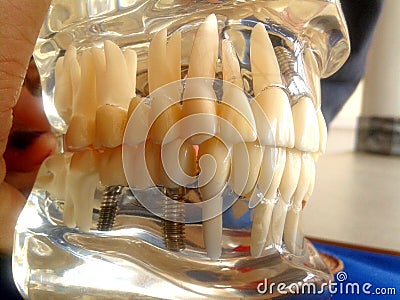 Dental study model Stock Photo