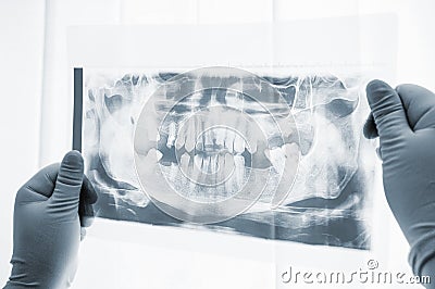 Dental surgery preparation x-ray scan close-up Stock Photo