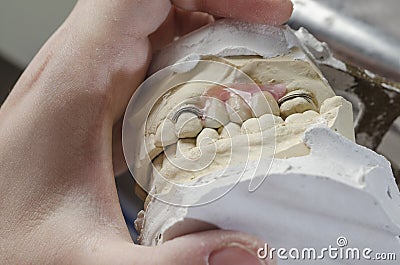 Dental technician doing partial dentures of acrylic resins. Stock Photo