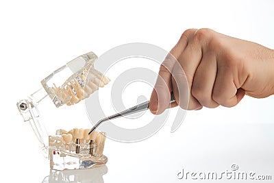 Dental technician placing the fixed partial denture Stock Photo