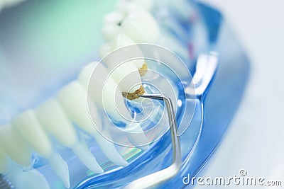 Dental teeth dentist model Stock Photo