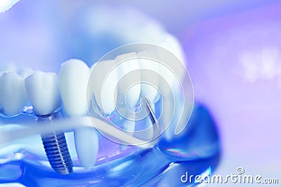 Dental teeth dentist model Stock Photo